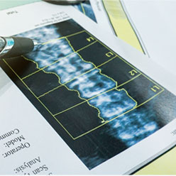 Bone Density testing at North Fulton Internal Medicine Group | Internal Medicine Physicians in Roswell